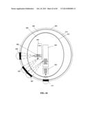 NEUROMODULATION DEVICES AND METHODS diagram and image