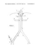 CANNULA FOR CARRYING OUT A REGIONAL EXTRACORPOREAL CIRCULATION diagram and image