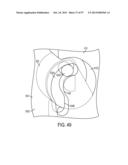 Syringe Pump and Related Method diagram and image