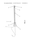 DEVICES AND METHODS FOR ANTERIOR ARYTENOID ADDUCTION diagram and image