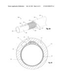 RETROGRADE CARDIOPLEGIA DELIVERY CATHETER AND METHOD FOR INDUCING     CARDIOPLEGIC ARREST diagram and image