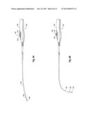 RETROGRADE CARDIOPLEGIA DELIVERY CATHETER AND METHOD FOR INDUCING     CARDIOPLEGIC ARREST diagram and image