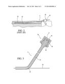 MEDICAL DEVICE FOR ANCHORING A GUIDEWIRE DURING A PERCUTANEOUS CORONARY     INTERVENTION diagram and image