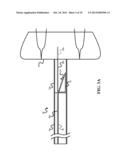 DETACHMENT TOOL FOR DECOUPLING A SHAPE SENSOR FROM AN IMPLANTABLE DEVICE diagram and image