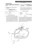 CIRCUMFERENTIAL ABLATION DEVICE ASSEMBLY diagram and image