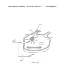 CIRCUMFERENTIAL ABLATION DEVICE ASSEMBLY diagram and image