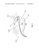 CATHETER NAVIGATION SYSTEM diagram and image