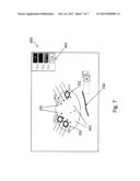 CATHETER NAVIGATION SYSTEM diagram and image