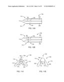 SURGICAL APPARATUS AND METHOD diagram and image