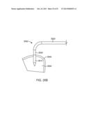 SURGICAL APPARATUS AND METHOD diagram and image