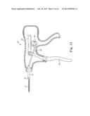 SUTURING SYSTEM AND ASSEMBLY diagram and image