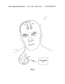 CHARGE-BALANCING DURING ELECTRICAL STIMULATION diagram and image