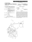 IMPLANTABLE MEDICAL DEVICE LEAD INCLUDING A UNIFILAR COILED CABLE diagram and image