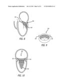 HEART VALVE ASSEMBLY SYSTEMS AND METHODS diagram and image