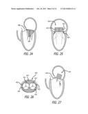 HEART VALVE ASSEMBLY SYSTEMS AND METHODS diagram and image