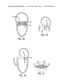 HEART VALVE ASSEMBLY SYSTEMS AND METHODS diagram and image