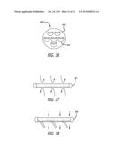 HEART VALVE ASSEMBLY SYSTEMS AND METHODS diagram and image