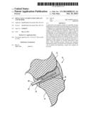 SPINAL FACET AUGMENTATION IMPLANT AND METHOD diagram and image