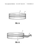 SPINAL FACET AUGMENTATION IMPLANT AND METHOD diagram and image