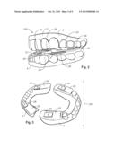 ORAL DEVICES, KITS, AND METHODS FOR REDUCING SLEEP APNEA, SNORING, AND/OR     NASAL DRAINAGE diagram and image