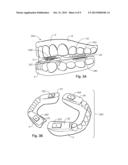 ORAL DEVICES, KITS, AND METHODS FOR REDUCING SLEEP APNEA, SNORING, AND/OR     NASAL DRAINAGE diagram and image