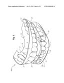 ORAL DEVICES, KITS, AND METHODS FOR REDUCING SLEEP APNEA, SNORING, AND/OR     NASAL DRAINAGE diagram and image