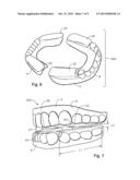 ORAL DEVICES, KITS, AND METHODS FOR REDUCING SLEEP APNEA, SNORING, AND/OR     NASAL DRAINAGE diagram and image