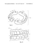 ORAL DEVICES, KITS, AND METHODS FOR REDUCING SLEEP APNEA, SNORING, AND/OR     NASAL DRAINAGE diagram and image