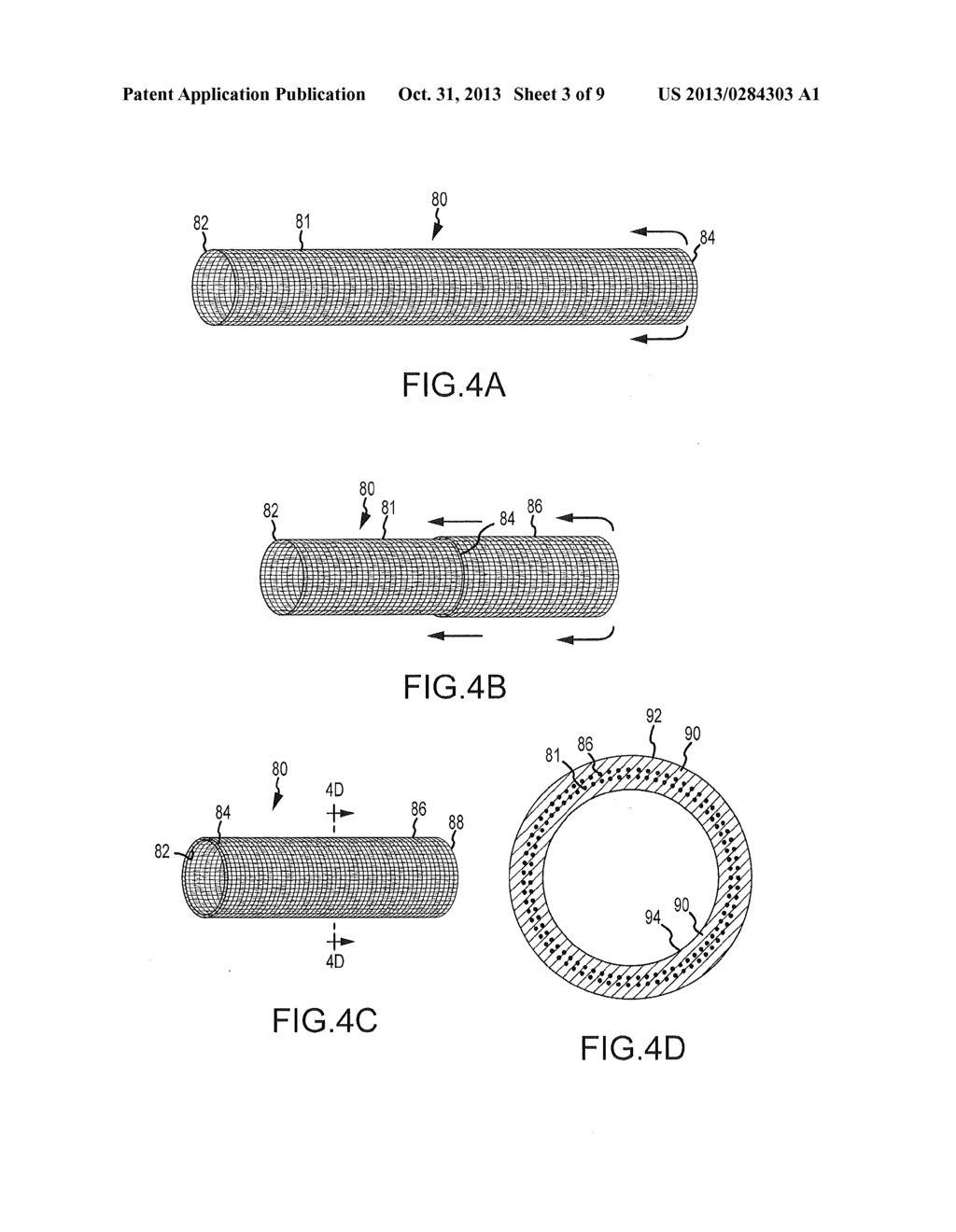 REINFORCEMENT METHODS FOR COMPOSITE TUBE FOR FLUID DELIVERY SYSTEM - diagram, schematic, and image 04