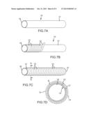 REINFORCEMENT METHODS FOR COMPOSITE TUBE FOR FLUID DELIVERY SYSTEM diagram and image