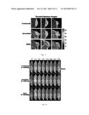 METHODS AND COMPOSITIONS FOR THE DETECTION OF CANCER CELLS diagram and image