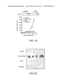 COMPOSITIONS COMPRISING SEMAPHORINS FOR THE TREATMENT OF ANGIOGENESIS     RELATED DISEASES AND METHODS OF SELECTION THEREOF diagram and image