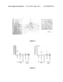 TREATMENT FOR DUPUYTREN S DISEASE diagram and image