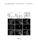 TREATMENT FOR DUPUYTREN S DISEASE diagram and image