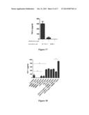 TREATMENT FOR DUPUYTREN S DISEASE diagram and image