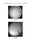 METHODS AND COMPOSITIONS FOR CELL-PROLIFERATION-RELATED DISORDERS diagram and image