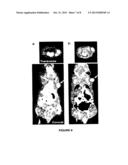 SIMPLIFIED ONE-POT SYNTHESIS OF [18F]SFB FOR RADIOLABELING diagram and image