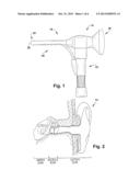 DEVICE AND METHOD FOR DETERMINING THE PRESENCE OF MIDDLE EAR FLUID diagram and image