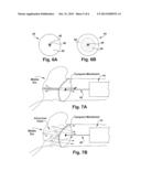 DEVICE AND METHOD FOR DETERMINING THE PRESENCE OF MIDDLE EAR FLUID diagram and image