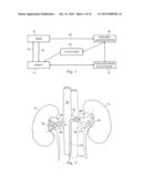 Methods and Apparatus for Renal Neuromodulation diagram and image