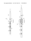 Methods and Apparatus for Renal Neuromodulation diagram and image