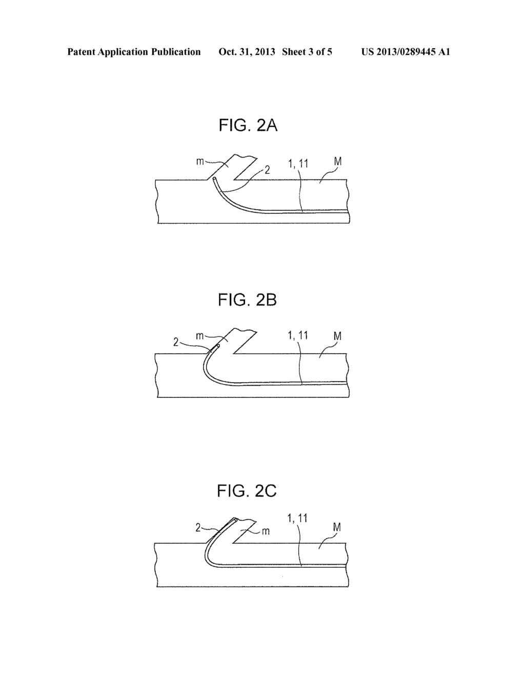 GUIDEWIRE - diagram, schematic, and image 04