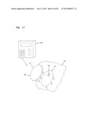 Analyte Monitoring Device and Methods of Use diagram and image