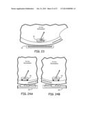 MAGNETIC-ANCHORED ROBOTIC SYSTEM diagram and image