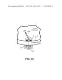 MAGNETIC-ANCHORED ROBOTIC SYSTEM diagram and image