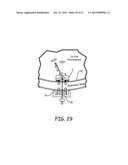 MAGNETIC-ANCHORED ROBOTIC SYSTEM diagram and image