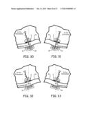 MAGNETIC-ANCHORED ROBOTIC SYSTEM diagram and image