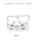 MAGNETIC-ANCHORED ROBOTIC SYSTEM diagram and image