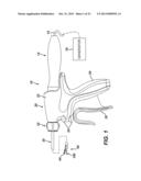 ULTRASONIC DEVICE FOR CUTTING AND COAGULATING diagram and image