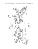 ULTRASONIC DEVICE FOR CUTTING AND COAGULATING diagram and image